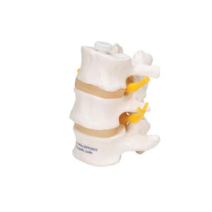 Lumbalcolumna m/3 virvler
