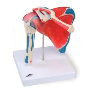 Skulderledd med rotator cuff, 5 deler
