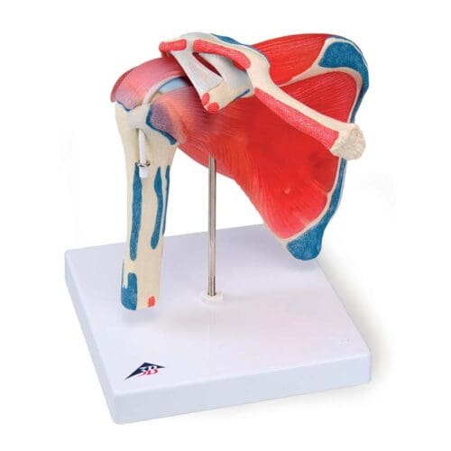 Skulderledd med rotator cuff, 5 deler