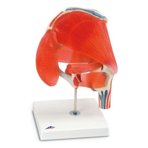 Hip joint, 7-piece